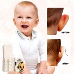 Mooli Silicon Disposable Ear Corrector - X8 - Image 8