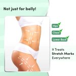 ⁦Mylo Stretch Marks Oil - 100ml⁩ - الصورة ⁦5⁩