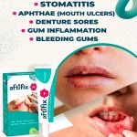 ⁦Aftifix Oral Gel 15g⁩ - الصورة ⁦2⁩