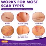 DFK Silicone Scar Sheets Roll for Surgical, Keloid, Acne, Burn & C-Section Scars (1.6" × 79" / 2M) - Image 2
