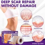 DFK Silicone Scar Sheets Roll for Surgical, Keloid, Acne, Burn & C-Section Scars (1.6" × 79" / 2M) - Image 3