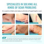 Advanced Scar Removal Cream Gel with 1% Retinol & 1% Allantoin - Reduces New & Old Scars, Softens, Hydrates & Renews Skin - Image 4